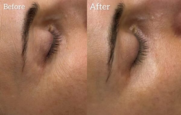 Beaubelle Advanced Eye Treatment